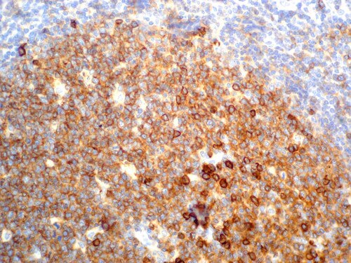 IHC of CD38 on an FFPE Tonsil Tissue